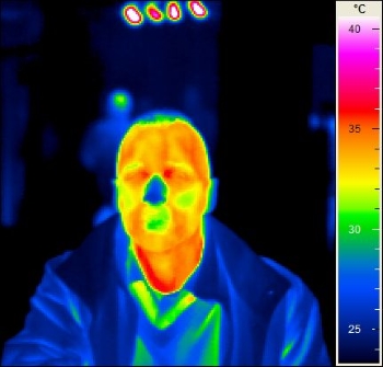 Thermal image record